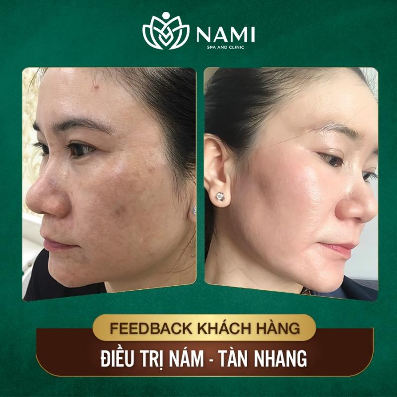 Nami Spa Beauty & Clinic