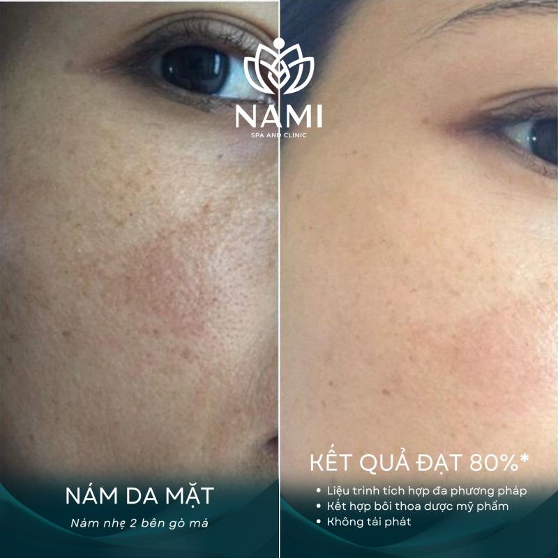 Nami Spa Beauty & Clinic