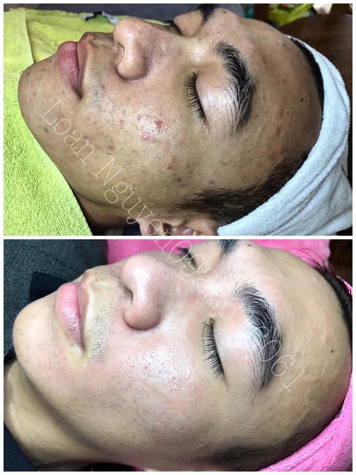 ﻿Loan Nguyen Skincare & Spa