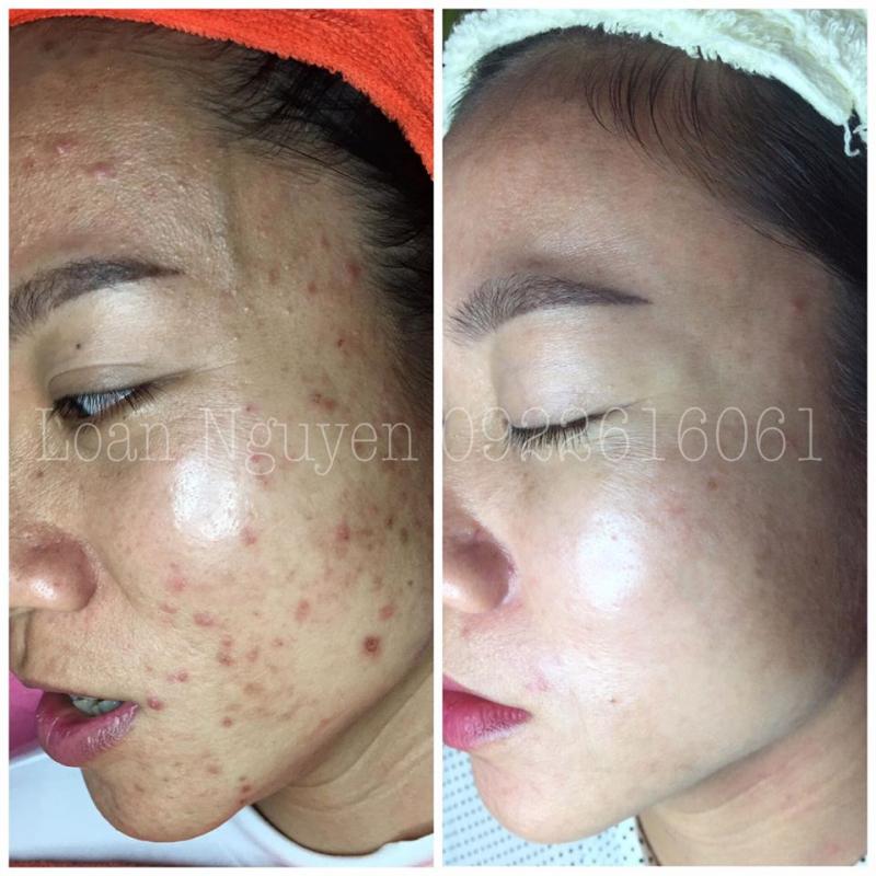 ﻿Loan Nguyen Skincare & Spa