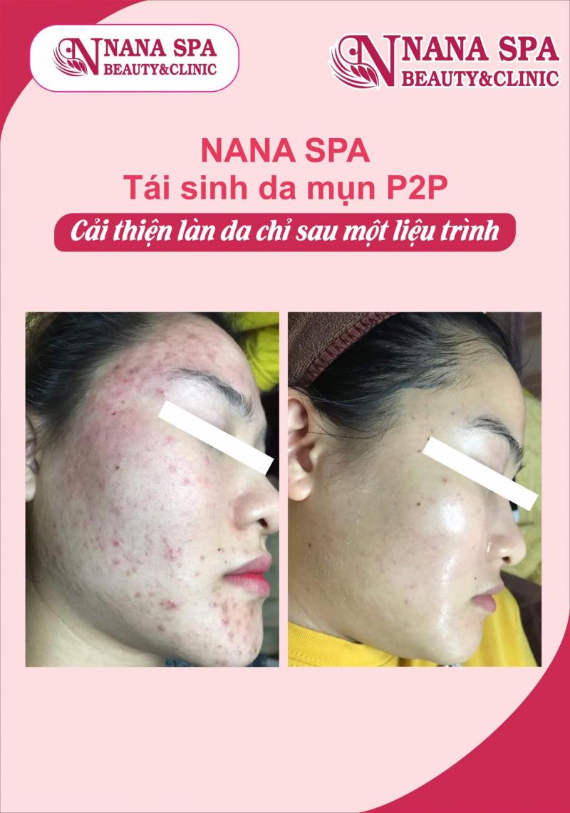 Nana Beauty & Spa