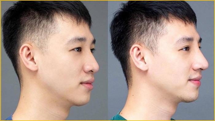 Ảnh minh hoạ (Nguồn internet)