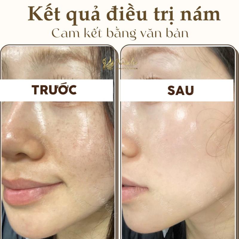 Natalie Beauty Center