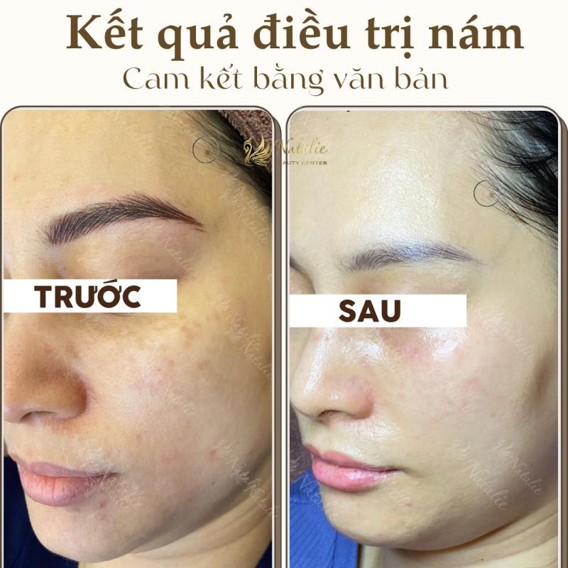 Natalie Beauty Center