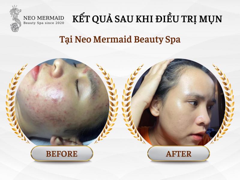 Neo Mermaid Beauty Spa