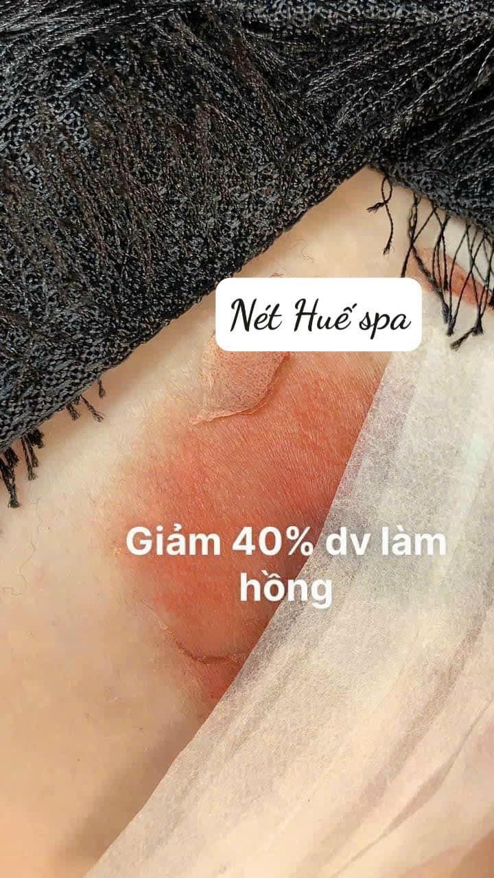 Nét Huế Spa