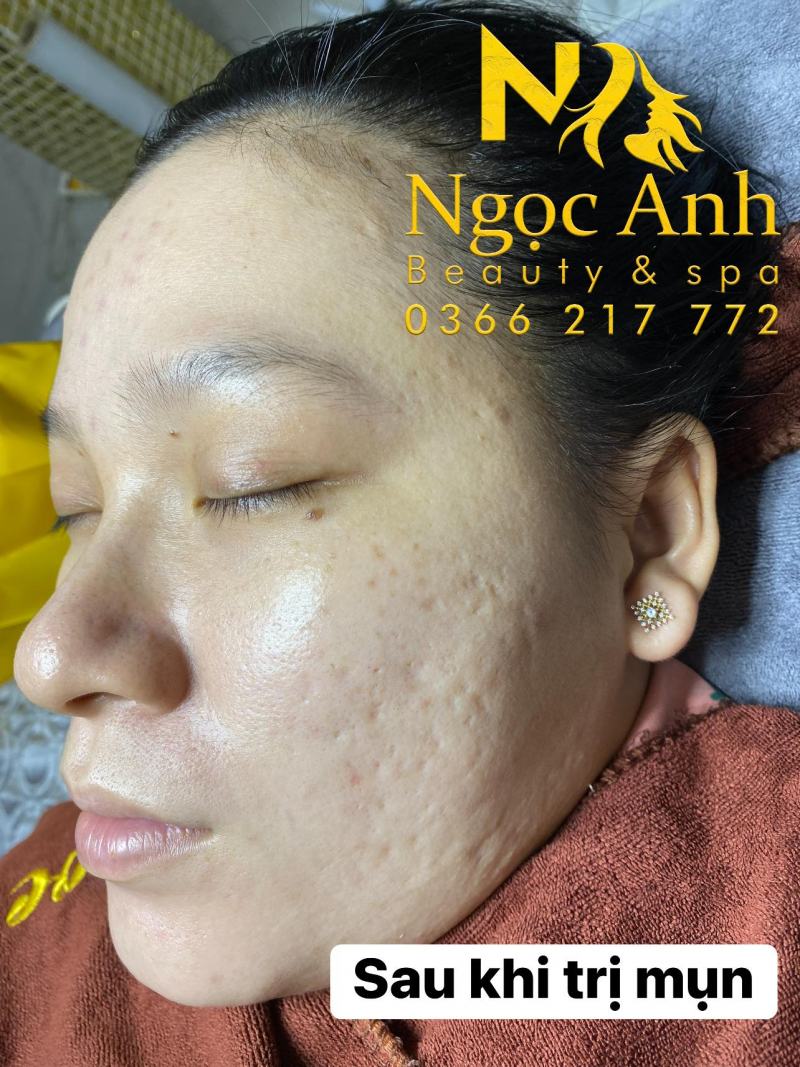 Ngọc Anh Spa