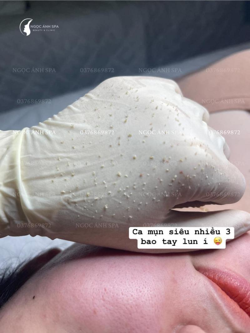 Ngọc Ánh Spa & Clinic