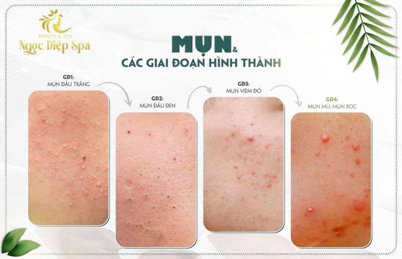 Ngọc Diệp Spa