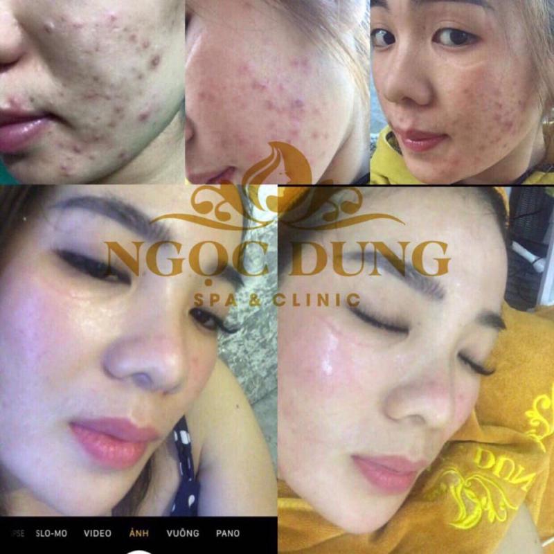 Ngọc Dung Spa & Clinic
