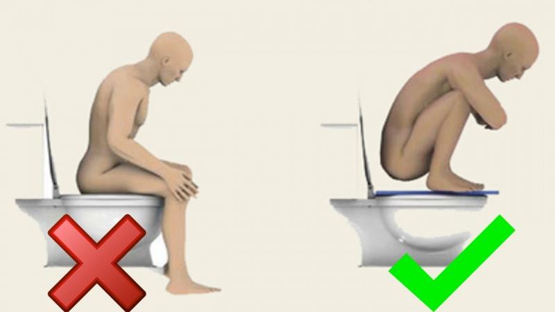 Bạn đã ngồi đúng tư thế khi đi vệ sinh chưa?