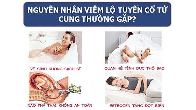 Nguyên nhân viêm lộ tuyến cổ tử cung thường gặp