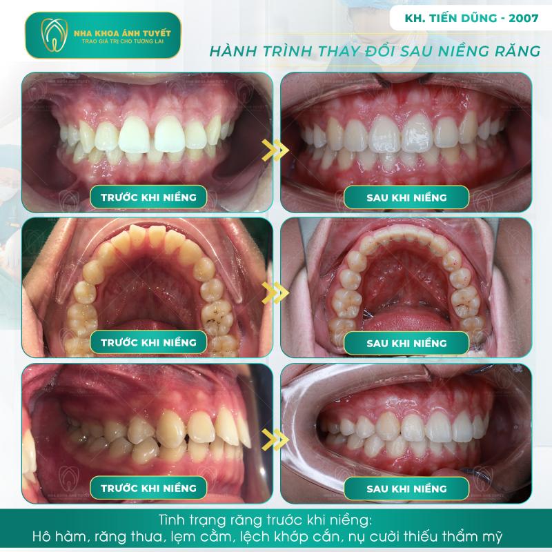 Nha Khoa Ánh Tuyết