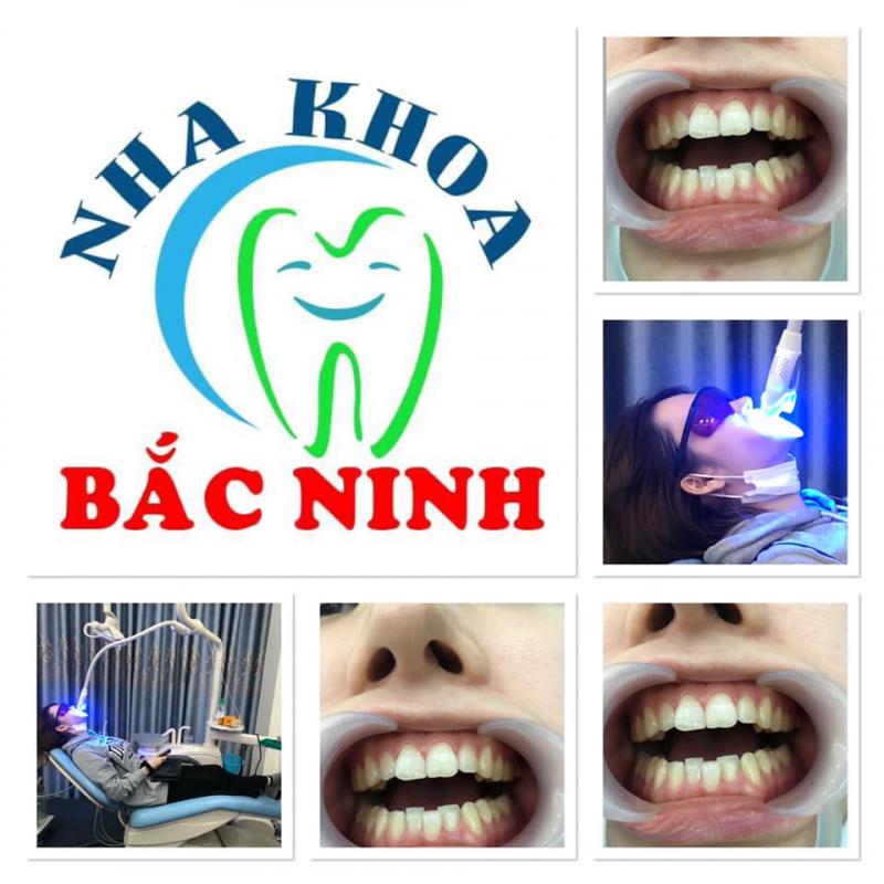 Nha Khoa Bắc Ninh