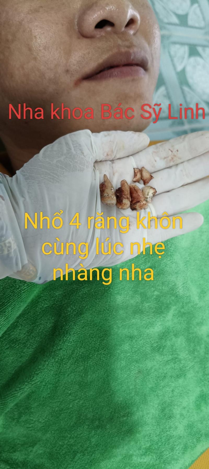 Nha Khoa Bác Sỹ Linh