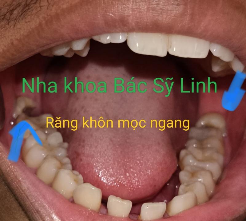 Nha Khoa Bác Sỹ Linh