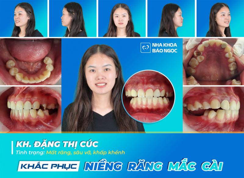 Nha khoa Bảo Ngọc