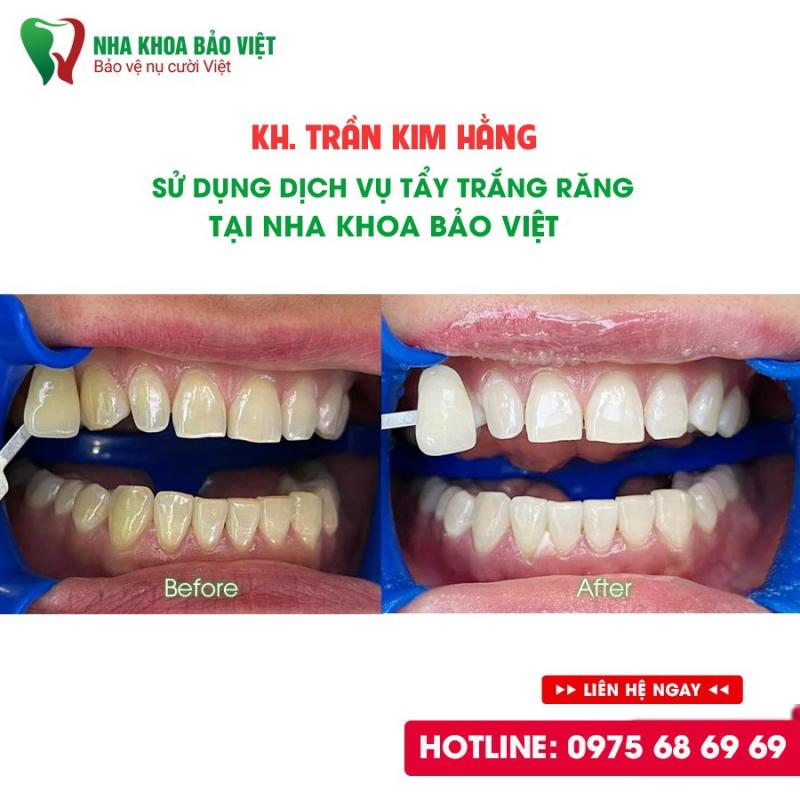 Nha khoa Bảo Việt- Bình Dương