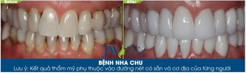 NHA KHOA BỆNH VIỆN JW HÀN QUỐC