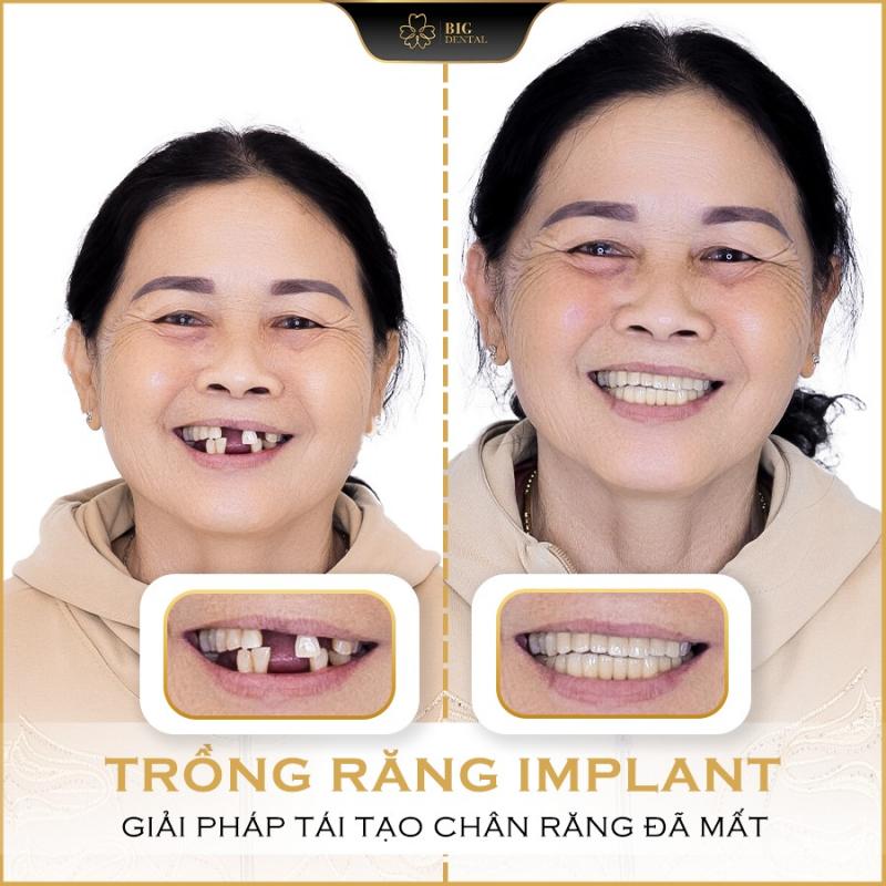 Nha Khoa Big Dental