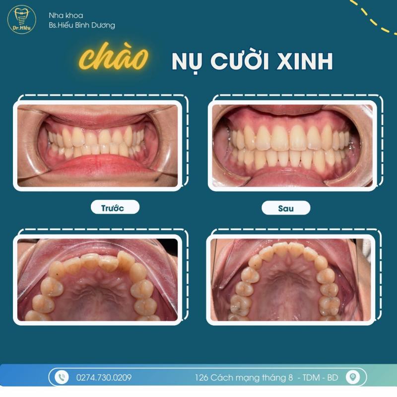 Nha khoa Dr. Hiếu
