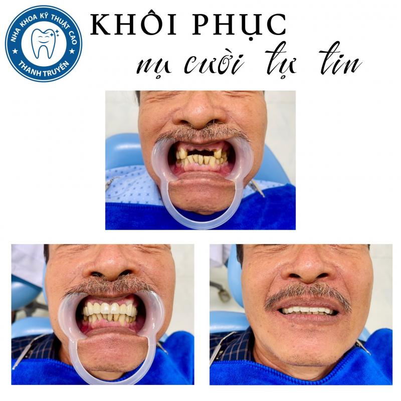 Nha Khoa Bs.Truyền