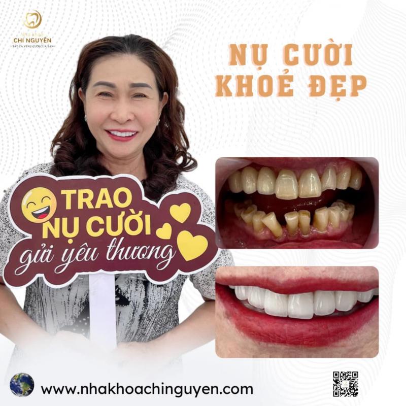 Nha Khoa Chi Nguyên - Biên Hoà Đồng Nai