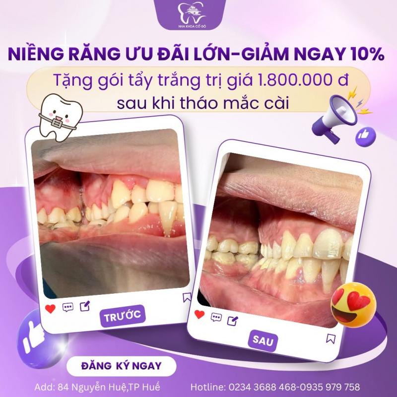 Nha Khoa Cố Đô