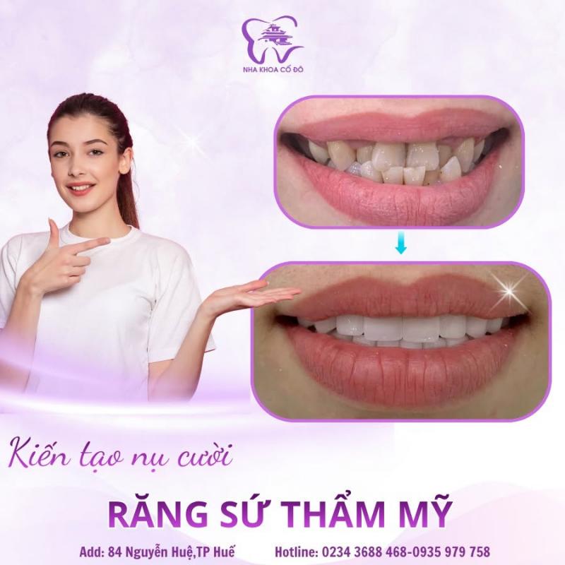 Nha Khoa Cố Đô