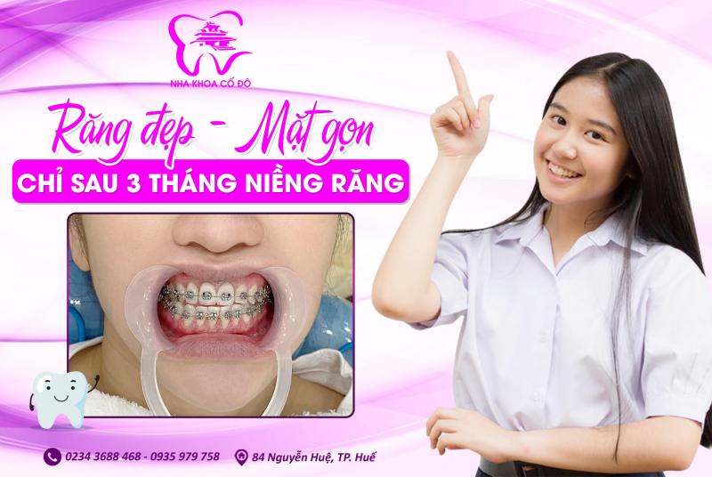 Nha Khoa Cố Đô