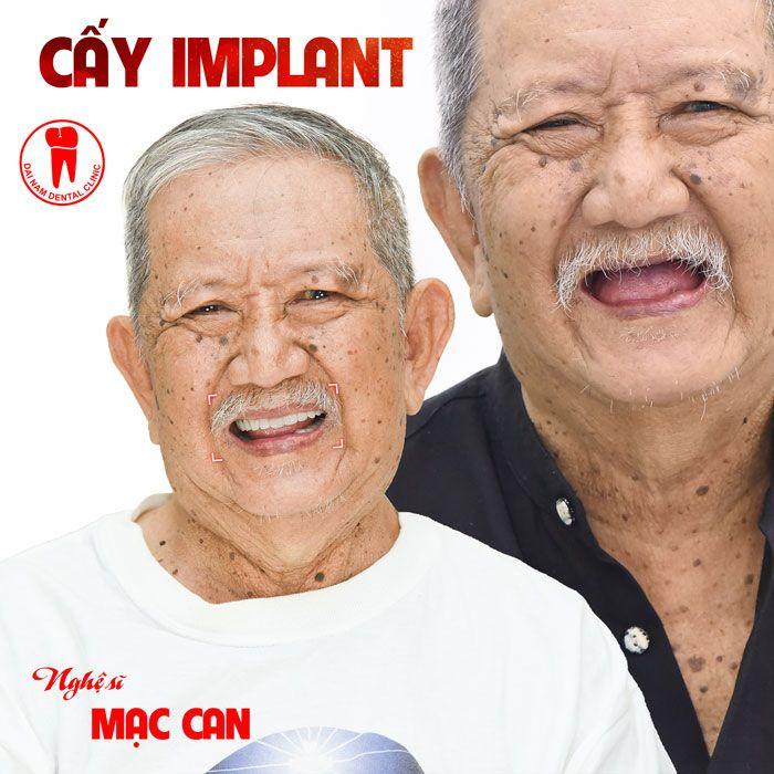 Nghệ sĩ Mạc Can trồng răng Implant tại Nha khoa Đại Nam