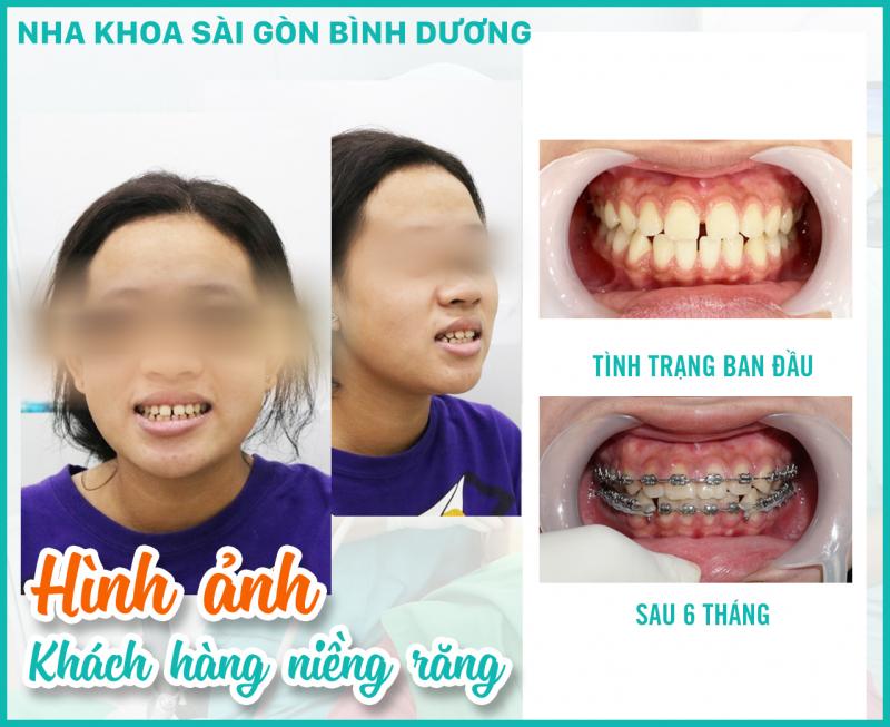 Nha Khoa Daknong - Nha Khoa Sài Gòn 9