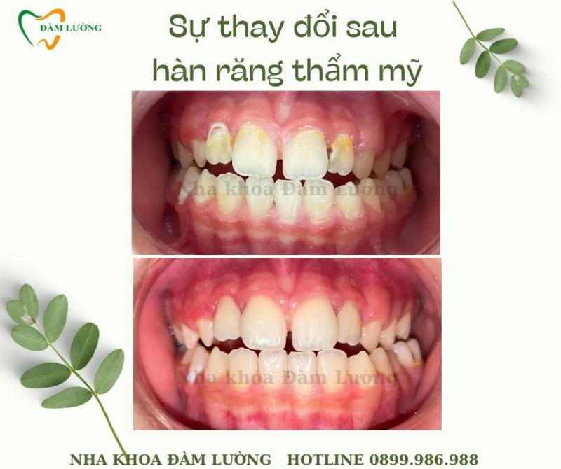 Nha khoa Đàm Lường