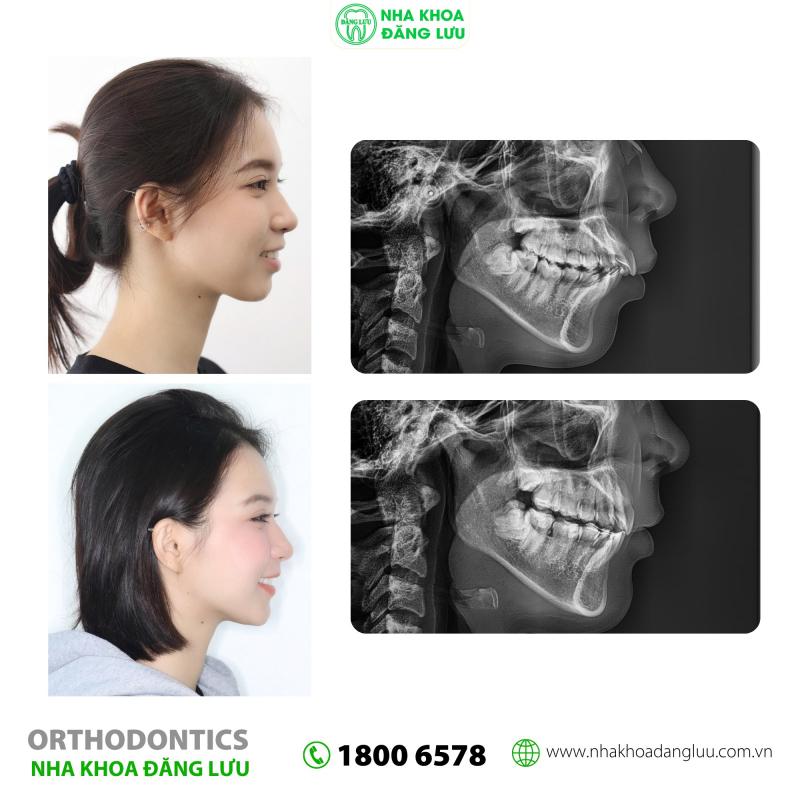 Nha Khoa Đăng Lưu