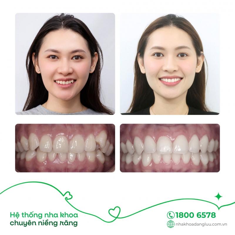Nha khoa Đăng Lưu