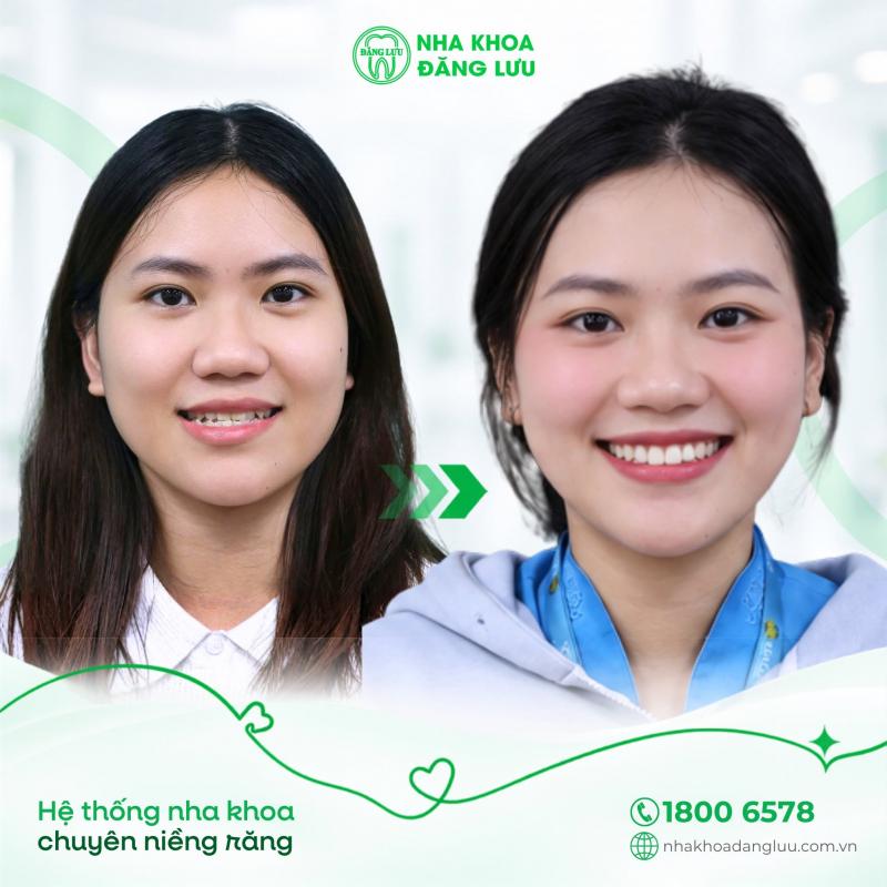 Nha khoa Đăng Lưu