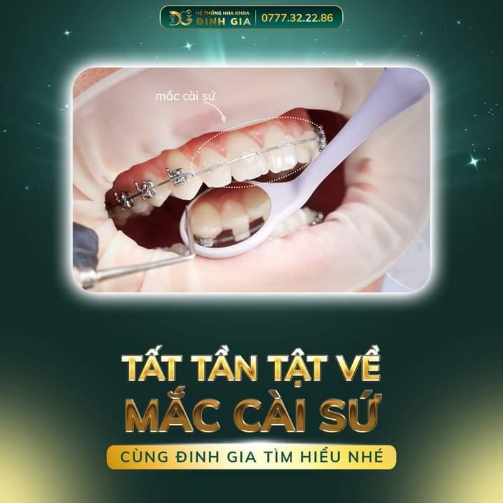 Nha Khoa Đinh Gia Đà Lạt