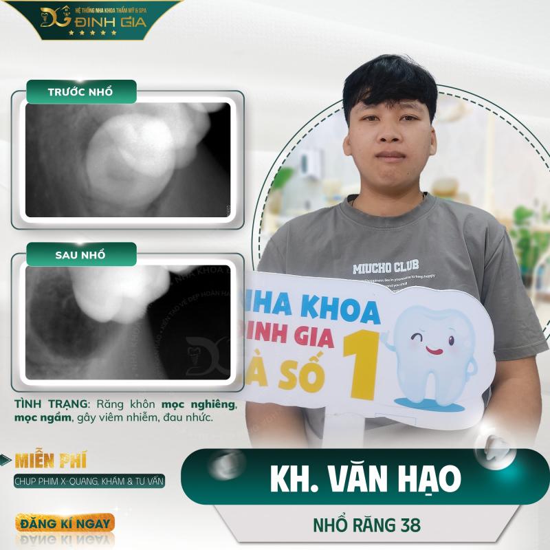 Nha Khoa Đinh Gia Đà Lạt