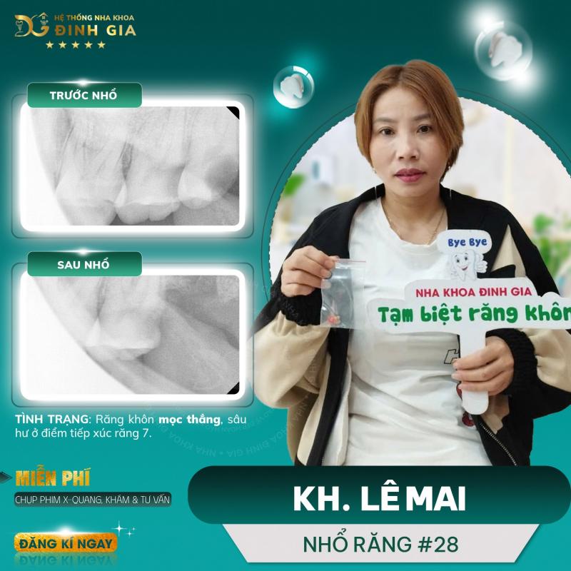 Nha Khoa Đinh Gia Đà Lạt