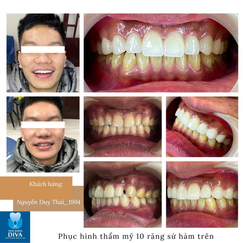 Nhà khoa Diva Dental