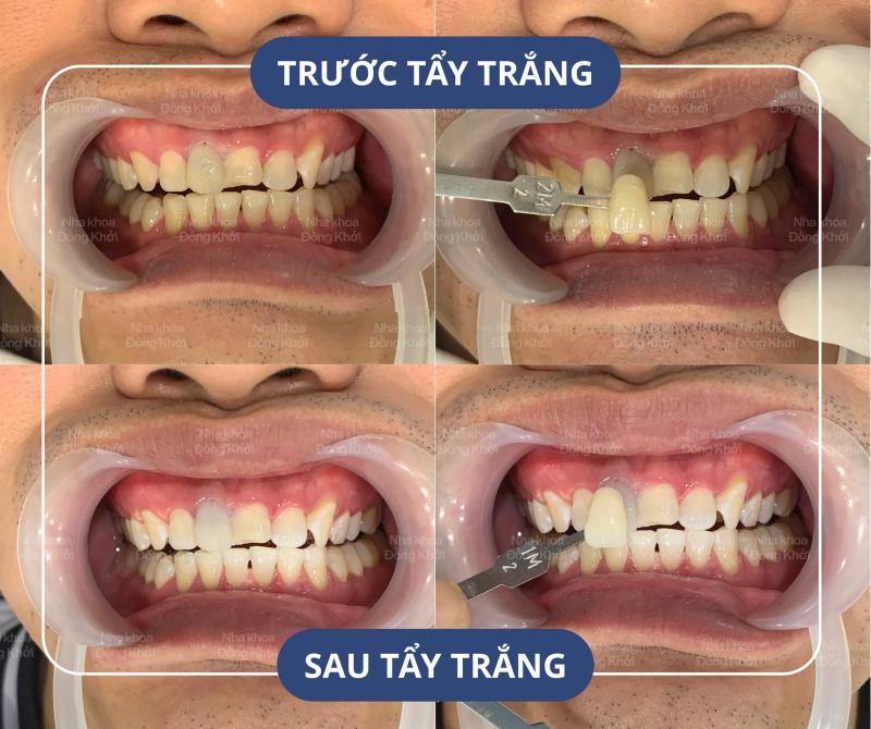 Nha Khoa Đồng Khởi