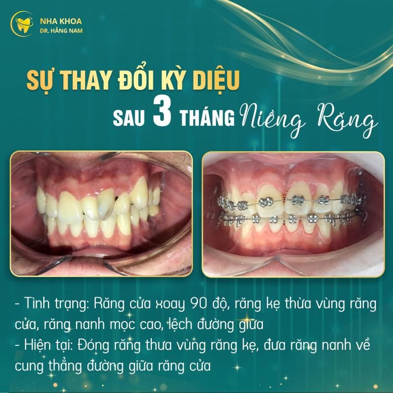 Nha khoa Dr. Hằng Nam