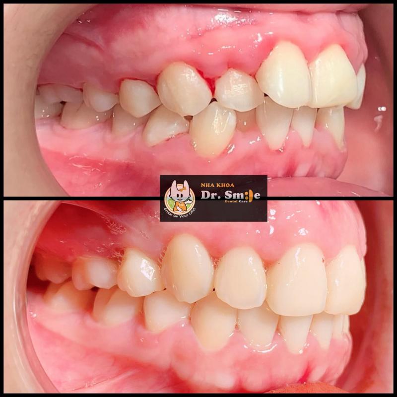 Nha khoa Dr. Smile Đà Lạt