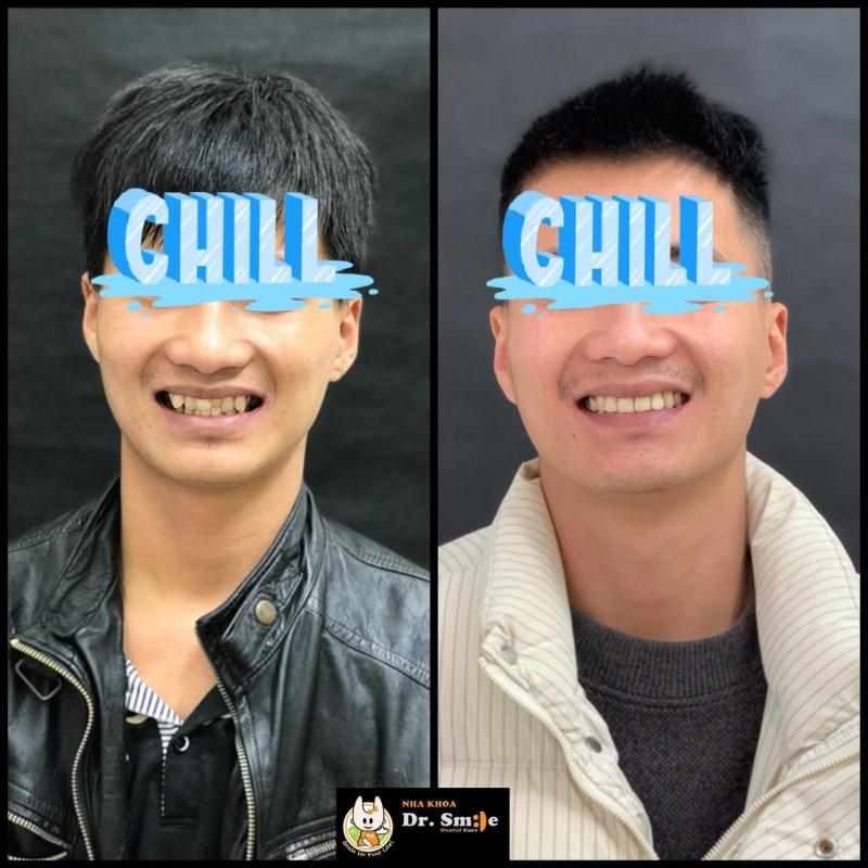 Nha khoa Dr. Smile Đà Lạt
