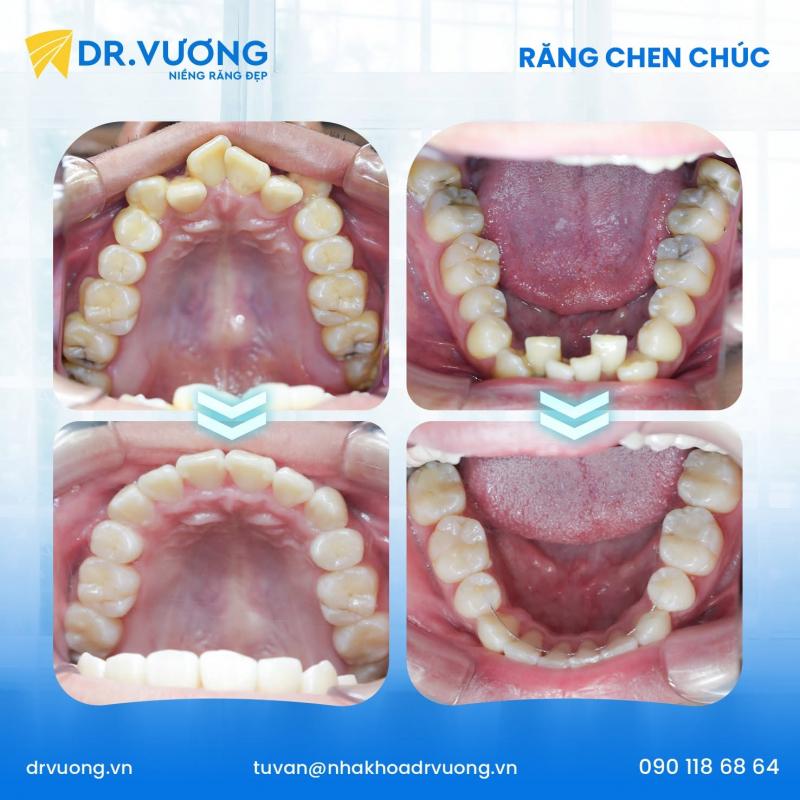 Nha Khoa Dr Vương