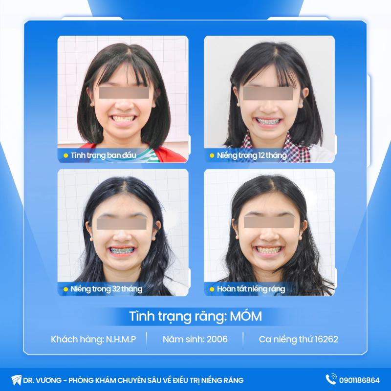 Nha Khoa Dr Vương