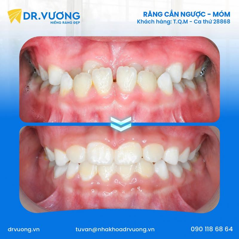 Nha khoa Dr.Vương