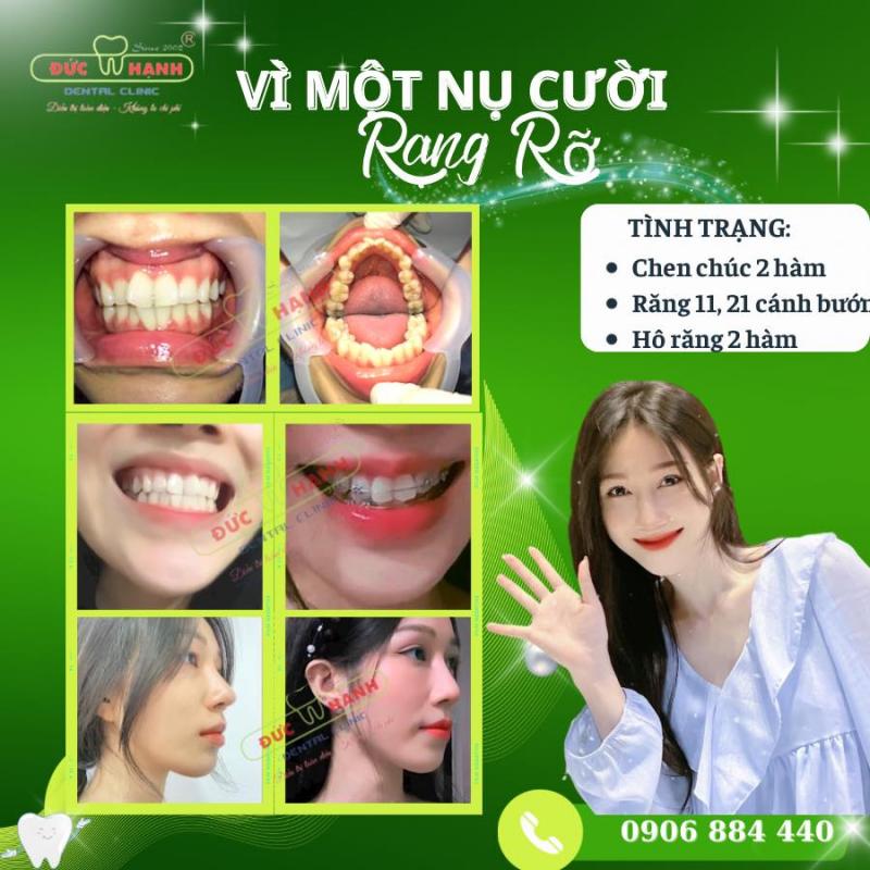 Nha khoa Đức Hạnh là hệ thống trung tâm nha khoa ﻿uy tín với lịch sử hoạt động hơn 20 năm