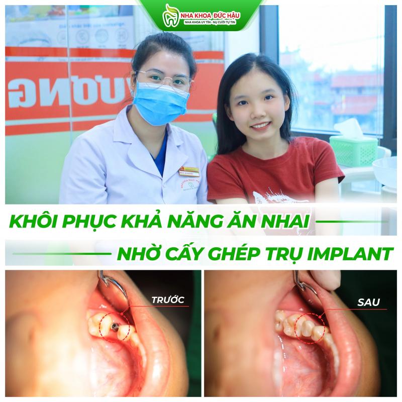 Nha Khoa Đức Hậu