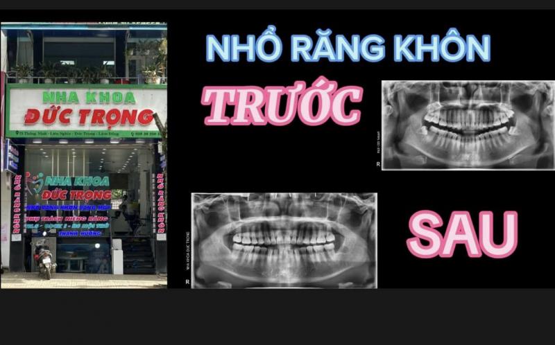 Nha khoa Đức Trọng